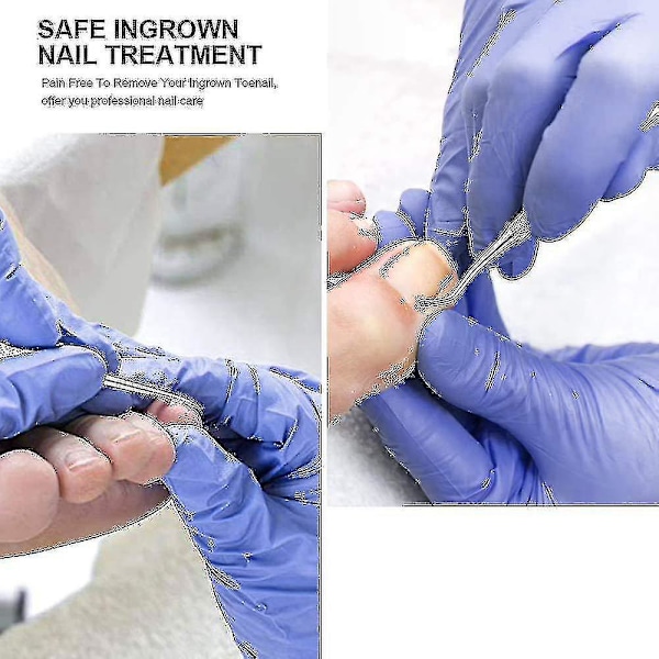 Tånagelsset, Manikyr Tillverkad av Högkvalitativt Rostfritt Stål för Nagelproblem, Tjocka Naglar och Paronyki (1 set, Silver)