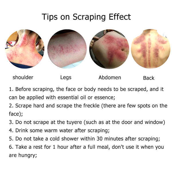 Gua Sha skrapa massageverktyg Gua Sha bräda skrapa verktyg för ansikte och kropp