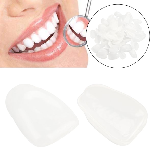 70 kpl pussihartsiyläinen väliaikainen hampaiden kruunu hampaiden suun hoitoon (valkoinen yläosa)