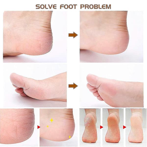 Professionelt pedicure værktøjssæt