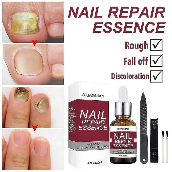 Nail Repair Kit , Effective Nail Repair Kit with 20ml Nail Repair Liquid, Nail File, Scissors and Brush for Damaged, Cracked, Generic