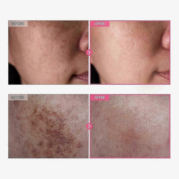 Arbutin 7% + Tranexamic Acid 4% Creme 50g (1 stk)