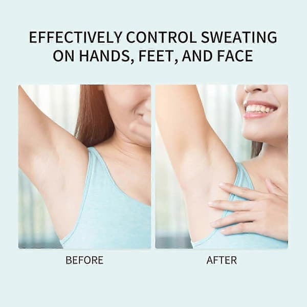 Antiperspirant Deodorant Spray 30ml til svedige hænder, svedige fødder, sved
