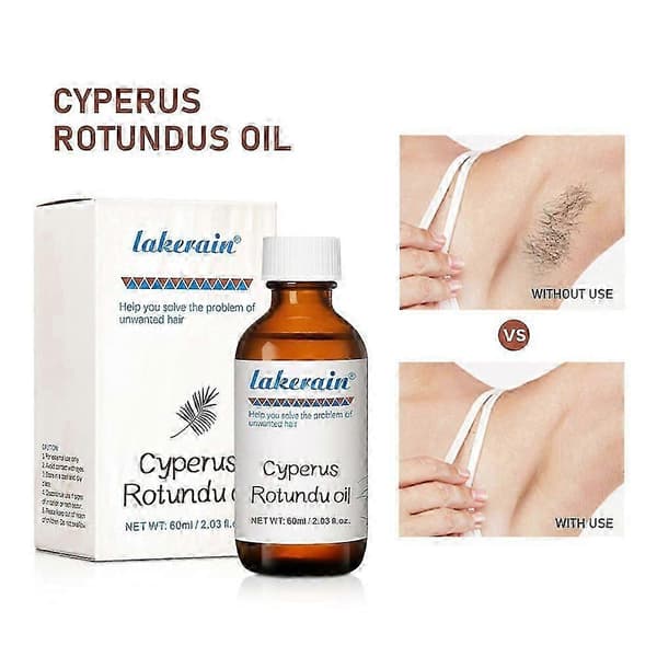 Luonnollinen Cyperus Rotundus -öljy karvanpoistoon - Puhdas ja tehokas, 60 ml pullo