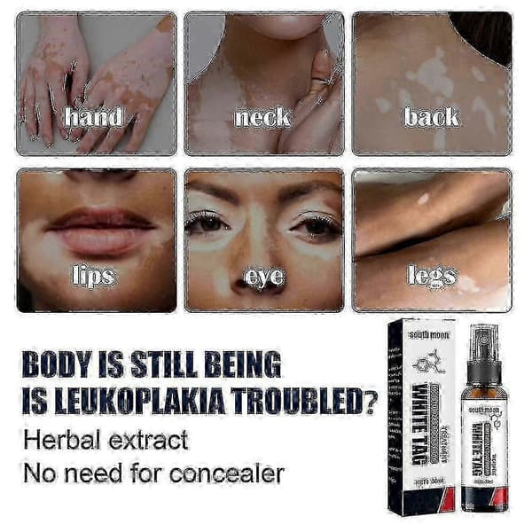 South Moon Vitiligo Behandlingsspray