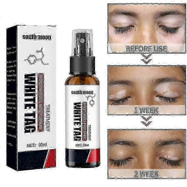 South Moon Vitiligo Behandlingsspray