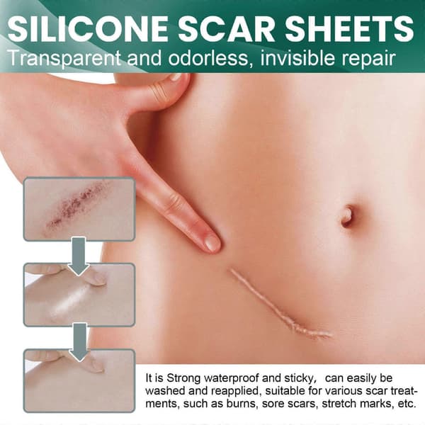 Silikon-arrplaster, silikon-arrstrips, usynlige silikon-arrplaster 4*3m