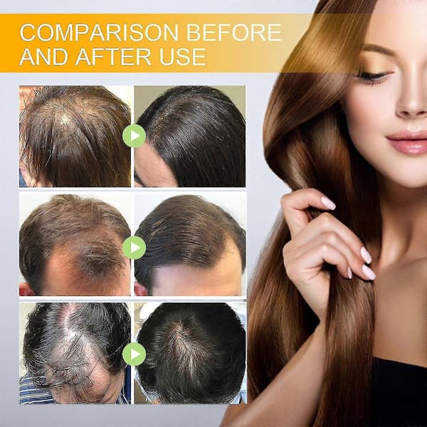 3 stk Biotin Anti-Hurtig Vekst Hårserum
