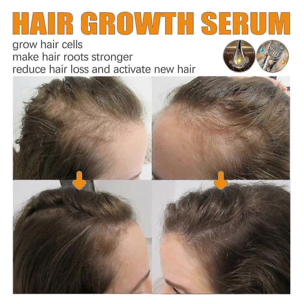 3 stk Biotin Anti-Hurtig Vekst Hårserum