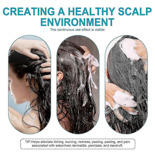 100 ml Psoriasis Shampoo Seborrheic Dermatitis Psoriasis Shampoo-Hovedbundsbehandling 25-26