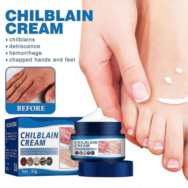 30ML Chilblain Cream Anti-cracking Frostbite Moisturiser Deep Nourishing Kit